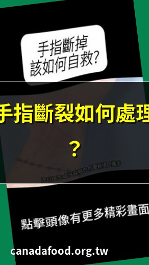 手指斷掉